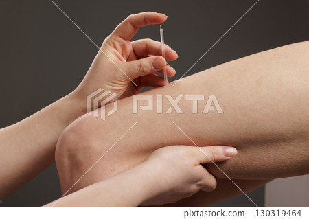 Professional dry needling technique for muscle pain relief, trigger point therapy and sports injury rehabilitation Professional dry needling technique for muscle pain relief, trigger point therapy and sports injury rehabilitation 130319464