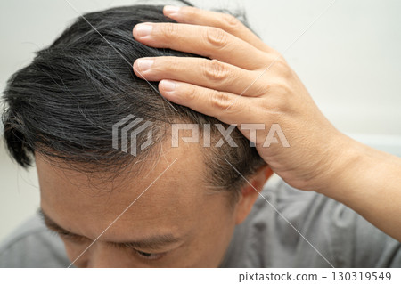 Bald in the middle head and begin no loss hair glabrous of mature Asian business smart active office man. Bald in the middle head and begin no loss hair glabrous of mature Asian business smart active office man. 130319549