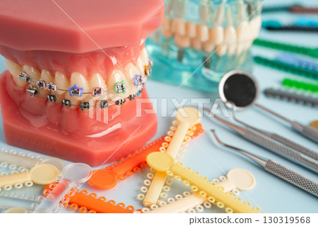 Orthodontic ligatures rings and ties, elastic rubber bands on orthodontic braces, model for dentist studying about dentistry. Orthodontic ligatures rings and ties, elastic rubber bands on orthodontic braces, model for dentist studying about dentistry. 130319568
