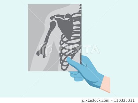 Medical doctor looking at x-ray picture of arm in hospital. 130323331