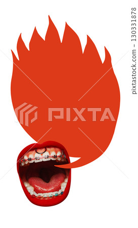 Bold colorful poster. Open mouth with braces shouting red flame shaped speech bubble with copy space 130331878