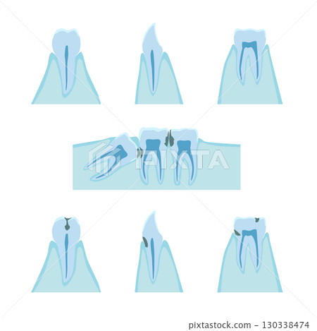 Cross-sectional image of teeth, gums, and cavities Cross-sectional image of teeth, gums, and cavities 130338474