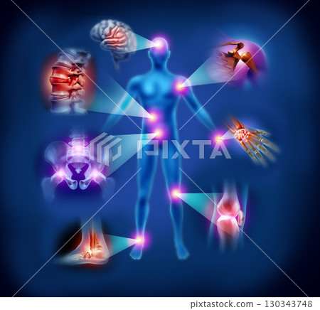 Chronic Inflammation Chronic Inflammation 130343748