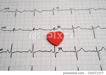 Electrocardiogram ECG, heart wave, heart attack, cardiogram report. 130371377