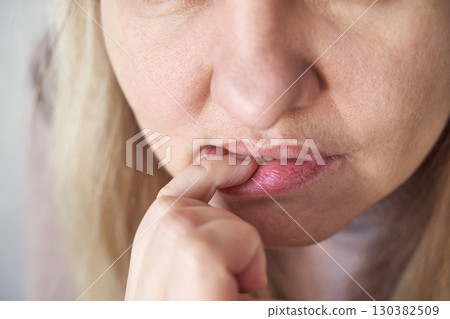 close up of caucasian female adult biting fingernails displaying nervousness 130382509