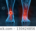Foot Pain Visualization 130424856