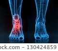 Foot Pain Visualization 130424859
