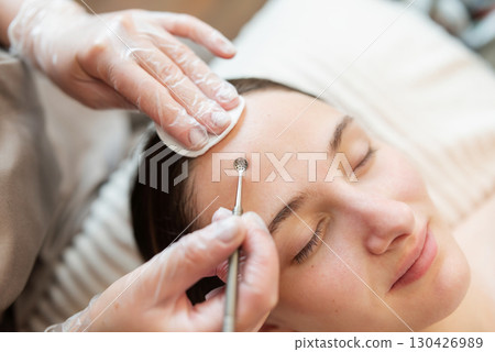 Cleaning pores of a client with mechanical cleaning technique. Close up of hands of a doctor cleaning skin on face of a client in cosmetology clinic Cleaning pores of a client with mechanical cleaning technique. Close up of hands of a doctor cleaning skin on face of a client in cosmetology clinic 130426989