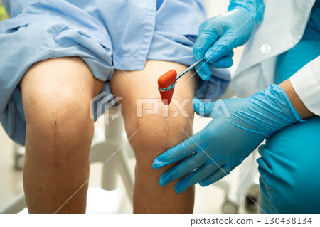 Asian doctor physiotherapist examining, massaging and treatment knee and leg of senior patient in orthopedist medical clinic nurse hospital. 130438134