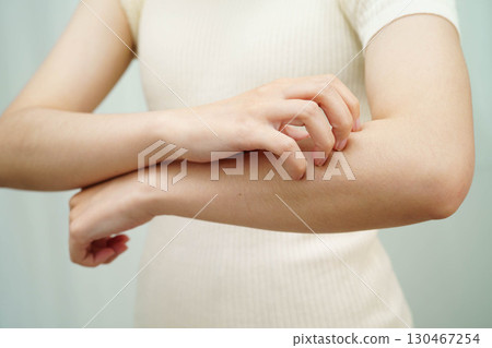 Asian woman itching of skin diseases using hand scratching. 130467254