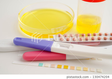 Urinalysis, urine cup with reagent strip pH paper test and comparison chart in laboratory. 130474204