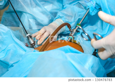 Surgeons performing minimally invasive procedure in a sterile operating room 130478783