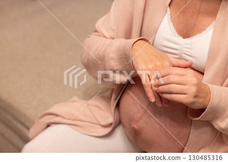 Pregnant woman massaging swollen fingers. Swollenness during pregnancy. 130485316
