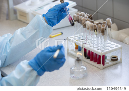 The hands of a physician laboratory assistant in an infectious disease laboratory examines the samples. The hands of a physician laboratory assistant in an infectious disease laboratory examines the samples. 130494849