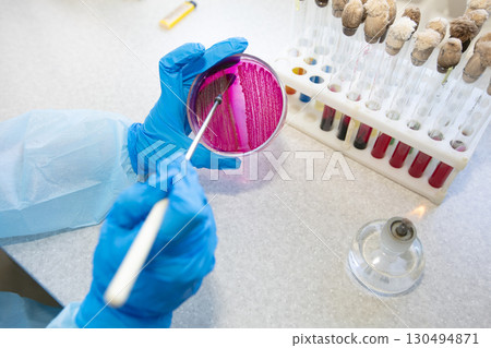 The hands of a physician laboratory assistant in an infectious disease laboratory examines the samples. 130494871