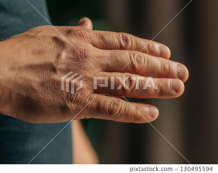 Middle-Aged Man Dry Hands and Brittle Nails Close-Up 130495594