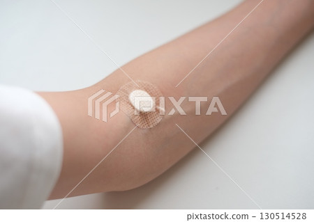 一名 40 多歲女性手臂的血液採樣後 一名 40 多歲女性手臂的血液採樣後 130514528
