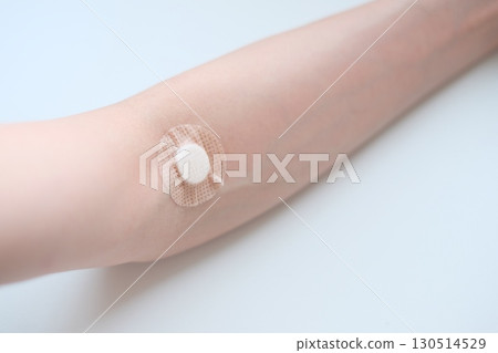 Arm of a woman in her 40s after blood sampling 130514529