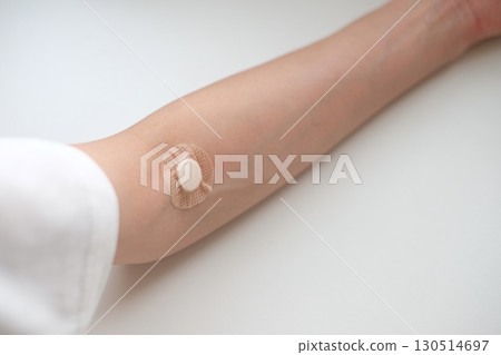 Arm of a woman in her 40s after blood sampling 130514697