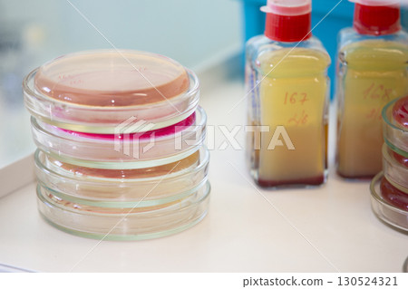 Bacterial colonies of streptococci with alpha hemolytics on a blood agar plate. Infection laboratory at the hospital. 130524321