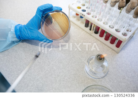 The hands of a physician laboratory assistant in an infectious disease laboratory examines the samples. 130524336