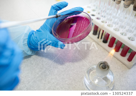 The hands of a physician laboratory assistant in an infectious disease laboratory examines the samples. 130524337