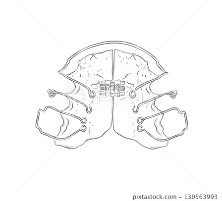 Orthodontic align teeth plate illustration Orthodontic align teeth plate illustration 130563993