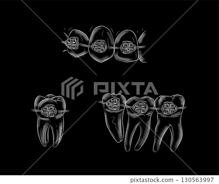 Teeth with braces illustration black 130563997