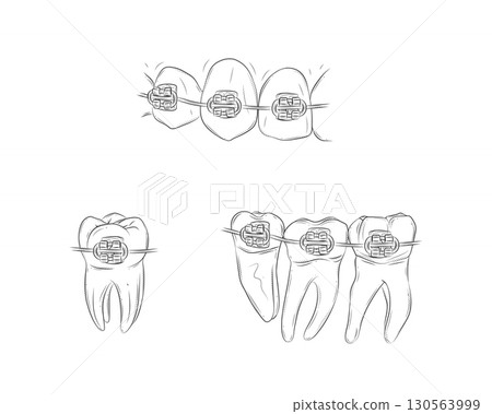 Teeth with braces illustration 130563999