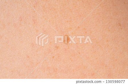Skin mole spot closeup. Human birthmark, nevus macro texture 130598077