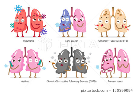 Set of lung disease cartoon illustration . Including pneumonia, lung cancer, pulmonary tuberculosis, asthma, COPD, pneumothorax . Isolated white background . Vector . 130599094