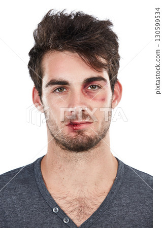 Portrait, facial and injury by man in studio for black eye, accident or fight on white background. Face, danger and domestic violence victim with wound, blood and injured while standing isolated Portrait, facial and injury by man in studio for black eye, accident or fight on white background. Face, danger and domestic violence victim with wound, blood and injured while standing isolated 130599534