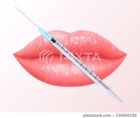 Vector illustration of pink lips with injection syringe. Perfect for beauty, makeup, and lip augmentation concept. Woman's kiss, a smile. Glossy and glamorous look. 3D realistic lips in vibrant color. Vector illustration of pink lips with injection syringe. Perfect for beauty, makeup, and lip augmentation concept. Woman's kiss, a smile. Glossy and glamorous look. 3D realistic lips in vibrant color. 130600788