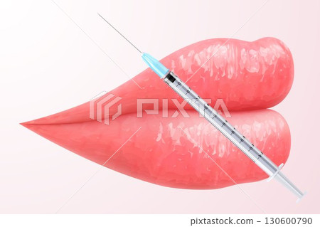 Vector illustration of pink lips with injection syringe. Perfect for beauty, makeup, and lip augmentation concept. Woman's kiss, a smile. Glossy and glamorous look. 3D realistic lips in vibrant color. 130600790