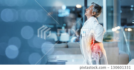 Elderly woman, doctor with back pain, spine injury with anatomy red overlay, burnout and fatigue with emergency. Health, hospital and bokeh with muscle inflammation and medical mockup with rheumatism 130601331