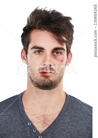 Man, portrait and black eye in studio for fight, conflict and hurt, bruise and abuse victim on white background. Face, male and facial injury, blood and wound, domestic violence and scratch isolated Man, portrait and black eye in studio for fight, conflict and hurt, bruise and abuse victim on white background. Face, male and facial injury, blood and wound, domestic violence and scratch isolated 130604268