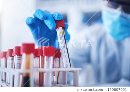 Hands, test tube or black woman doctor in lab with blood DNA for research, medical exam and sample analysis. Healthcare, biotechnology or scientist thinking with liquid vial, medicine and vaccine 130607901
