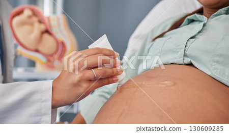 Hand, stomach or pregnant with a doctor in hospital to apply gel to the skin of a woman during an appointment or checkup. Mother, health and pregnancy with the belly of a female parent in a clinic Hand, stomach or pregnant with a doctor in hospital to apply gel to the skin of a woman during an appointment or checkup. Mother, health and pregnancy with the belly of a female parent in a clinic 130609285