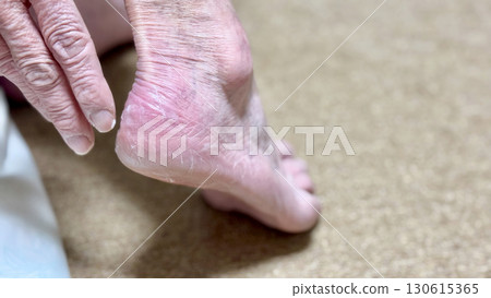 一位老婦人伸手去夠她粗糙的鞋跟 一位老婦人伸手去夠她粗糙的鞋跟 130615365