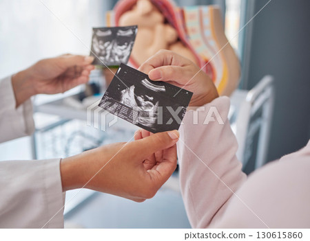 Doctor, hands and woman with ultrasound photo for fetus growth, development or family planning in clinic. Black woman medic, sonogram picture or healthcare for mother patient at hospital in pregnancy 130615860
