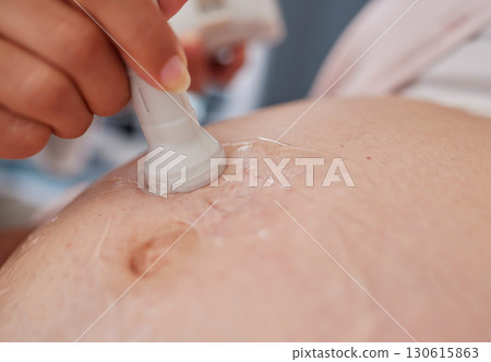 Doctor hand, ultrasound and pregnancy stomach for reading, health and family planning for future mother. Zoom closeup of medic, pregnant woman and sonogram with medical tech on abdomen for healthcare Doctor hand, ultrasound and pregnancy stomach for reading, health and family planning for future mother. Zoom closeup of medic, pregnant woman and sonogram with medical tech on abdomen for healthcare 130615863
