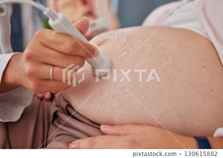 Pregnant woman, ultrasound and doctor hands with stomach scan for baby healthcare, medical support or gynecology. Pregnancy maternity consultation, hospital and patient abdomen with gynecologist help Pregnant woman, ultrasound and doctor hands with stomach scan for baby healthcare, medical support or gynecology. Pregnancy maternity consultation, hospital and patient abdomen with gynecologist help 130615882