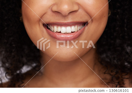 Black woman, teeth and smile for dental care, whitening or oral and mouth treatment. Closeup of happy African American female model smiling for dentist results, healthcare or clean tooth hygiene 130616101