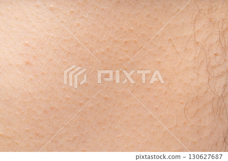 Wet human skin with water drops closeup. Sweat healthy body, macro shower drops on woman skin 130627687