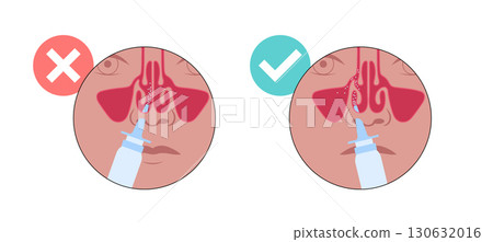 Proper nasal spray usage Proper nasal spray usage 130632016