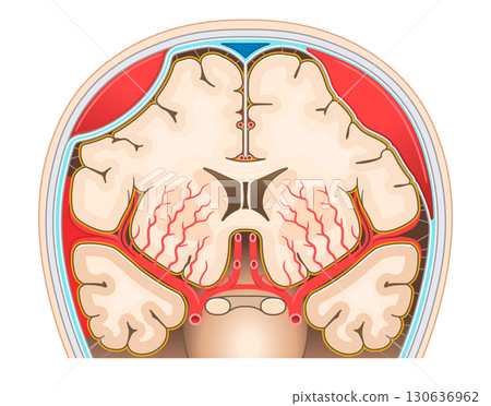 蛛網膜下腔出血、硬腦膜外血腫及硬腦膜下血腫的圖示 蛛網膜下腔出血、硬腦膜外血腫及硬腦膜下血腫的圖示 130636962