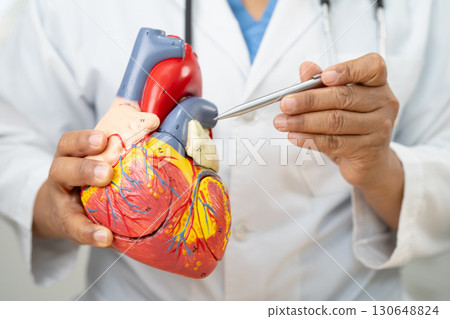 Cardiovascular disease CVD, Asian doctor holding human anatomy model for learn and treat heart disease. 130648824