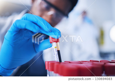 Science, blood and hands with test tube in laboratory for research, medical exam and sample analysis. Healthcare, pharmaceutical and black man scientist with vial for dna experiment, rna and genetics 130694083