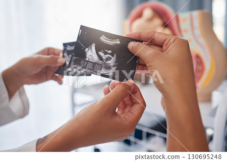Sonogram, showing and hands with an ultrasound of a baby from the doctor to mother at a clinic. Consultation, pregnancy and pregnant woman with a picture of a child from a gynecologist at hospital Sonogram, showing and hands with an ultrasound of a baby from the doctor to mother at a clinic. Consultation, pregnancy and pregnant woman with a picture of a child from a gynecologist at hospital 130695248