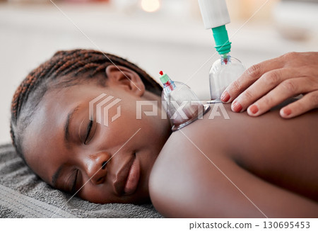 Black woman, hands and cupping therapy on back in spa for pain relief, blood flow and relaxation at resort. Hand of therapist with glass vacuum cups on African American female in deep tissue massage 130695453